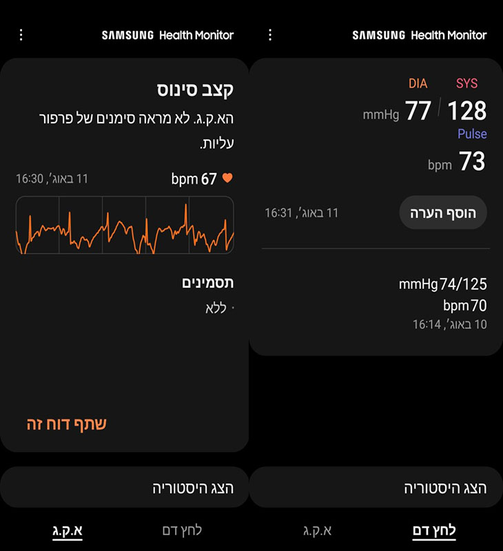 ניטור לחץ דם וקצב סינוס