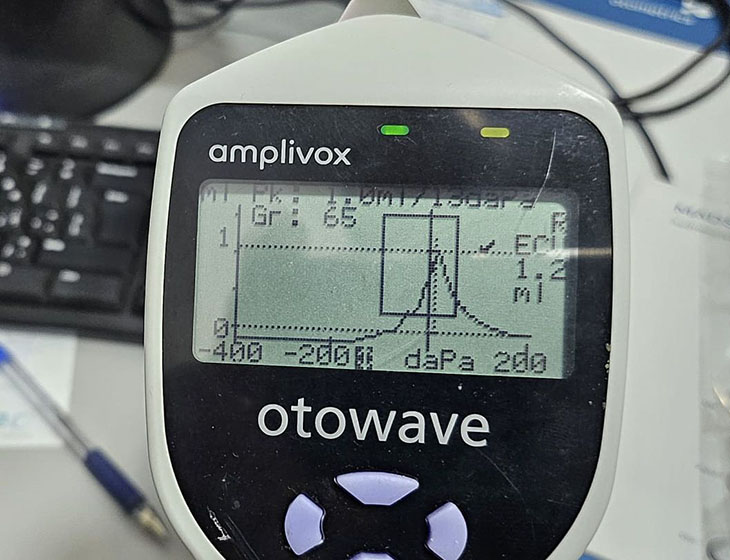 מכשיר מדידת לחץ על עור התוף